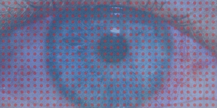 What to Do About Your Pink, Itchy Eyes