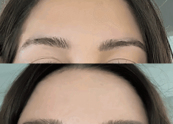 The Science of Scalp Well being