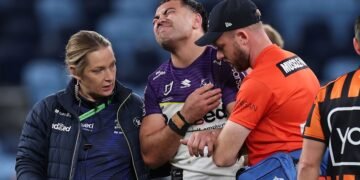 Jahrome Hughes shoulder damage replace after Melbourne Storm vs Sydney Roosters; Spherical 21 outcomes, video, damage replace
