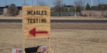 U.S. measles instances are the very best in 33 years, the CDC experiences : Pictures