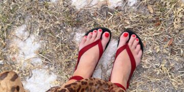 How To Cease Toes Swelling In Sizzling Climate