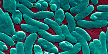 ‘Flesh-Consuming’ Micro organism Circumstances Rising on Gulf Coast: What to Know