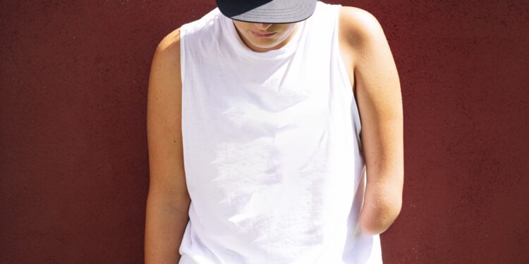 After an amputation, the mind remembers the physique’s misplaced limb : Photographs