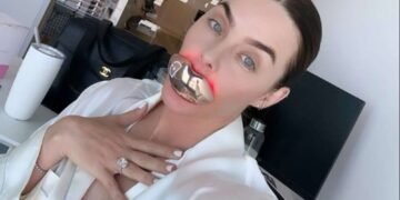 Give Your self a Whole Mouth Makeover