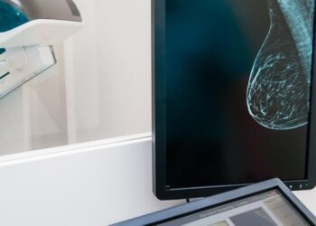 A New Examine Challenges the Method We Display screen for Breast Most cancers