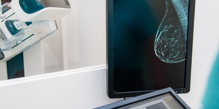 A New Examine Challenges the Method We Display screen for Breast Most cancers