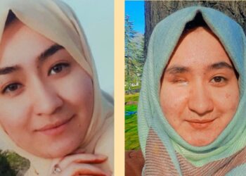 Afghan Scholar Who Misplaced An Eye In Terror Assault Vows To Battle For Change