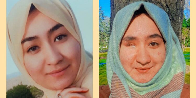 Afghan Scholar Who Misplaced An Eye In Terror Assault Vows To Battle For Change
