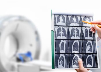Specialists Need Extra Individuals Screened for Lung Most cancers
