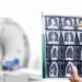 Specialists Need Extra Individuals Screened for Lung Most cancers