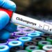Bavarian Nordic and SII signal settlement for chikungunya vaccine manufacturing