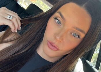 Get Rid of Hyperpigmentation Across the Mouth: Professional Ideas