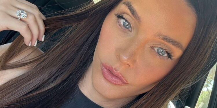 Get Rid of Hyperpigmentation Across the Mouth: Professional Ideas