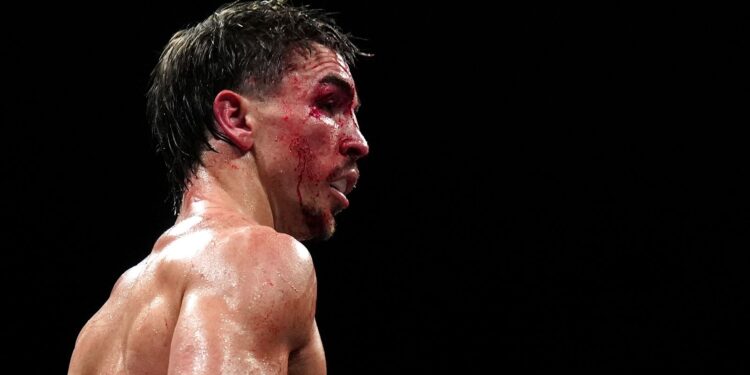 Michael Conlan suffers shock split-decision defeat to Kevin Walsh in his Belfast hometown | Boxing Information