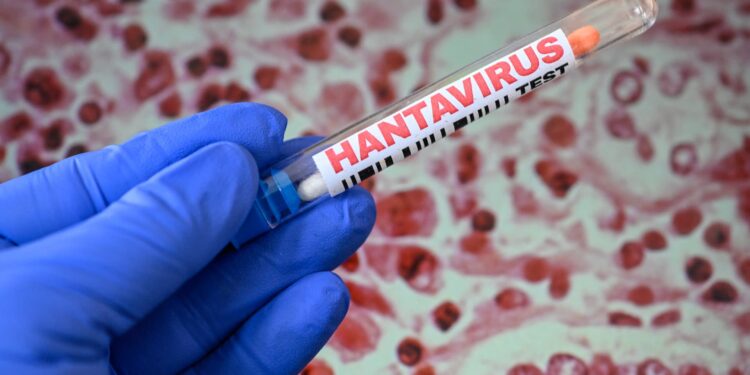 Hantavirus outbreak: Little probability says Kalshi