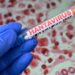 Hantavirus outbreak: Little probability says Kalshi