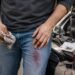 Get Transmission Fluid Out of Garments (Oil Plus Dye)